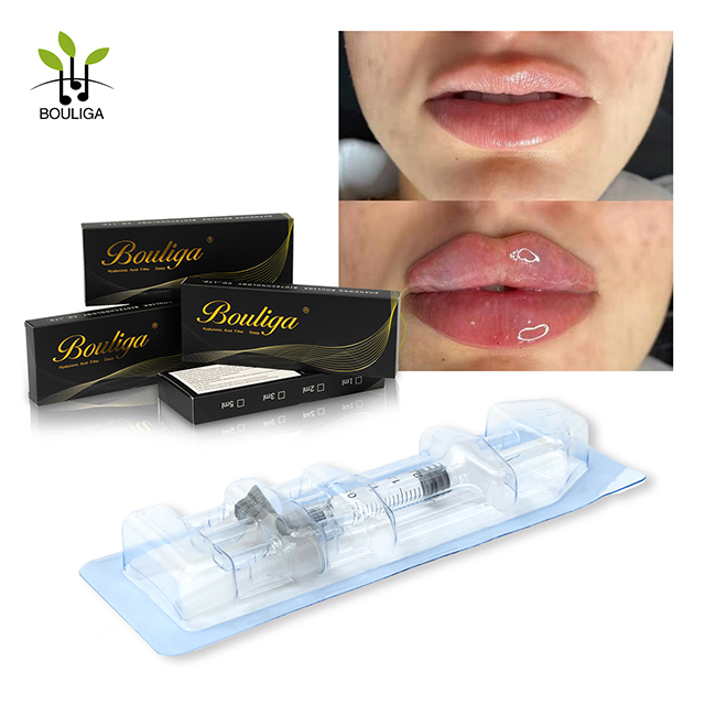 Fabrika Kaynağı Enjekte Edilebilir Hyaluronik Asit Dermal Dolgu Kırışıklıklar için dudak dolgusu 1 ml Derin