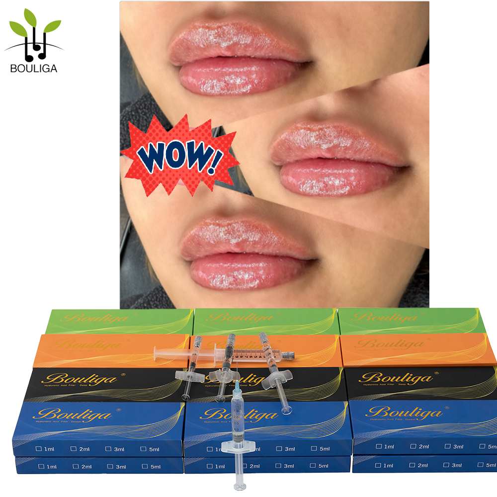 Bouliga Dermal dolgu 2ml dudaklar ve kırışıklıklar için kullanın